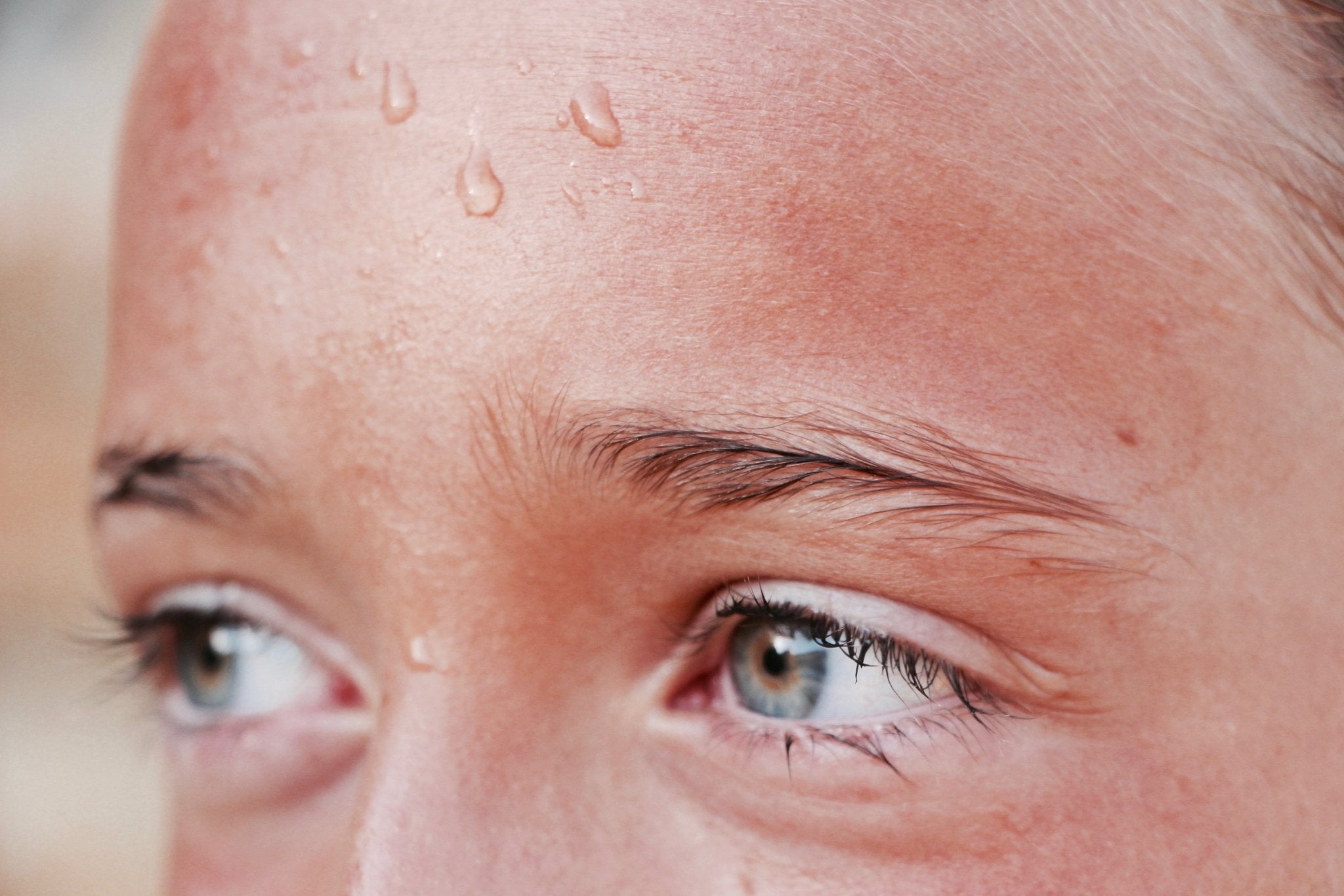 woman's face with sweat and red skin